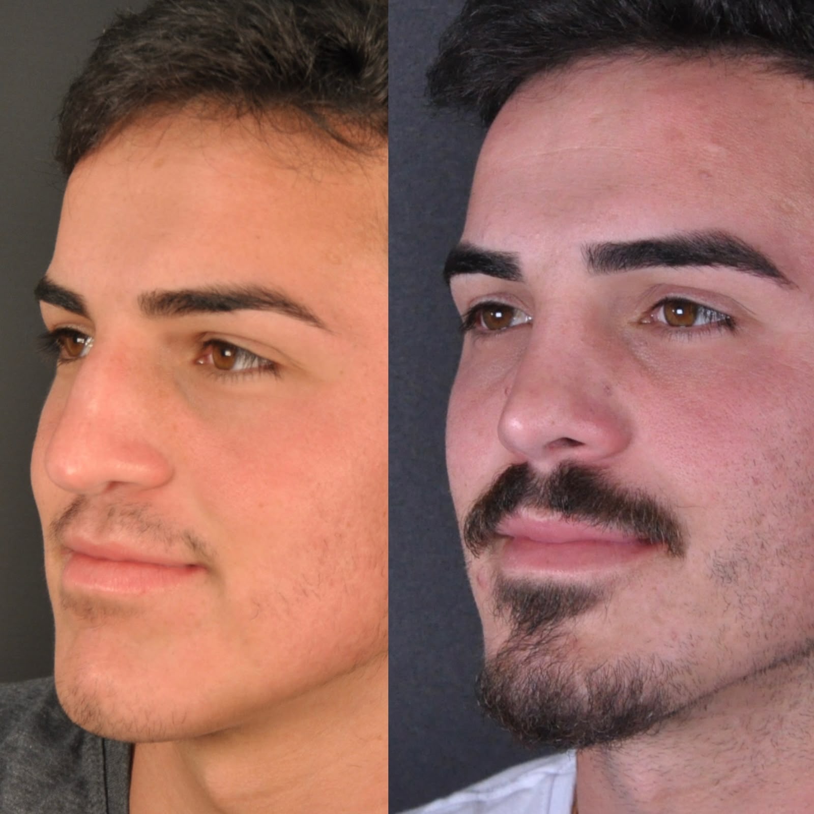 Antes e depois — masculino