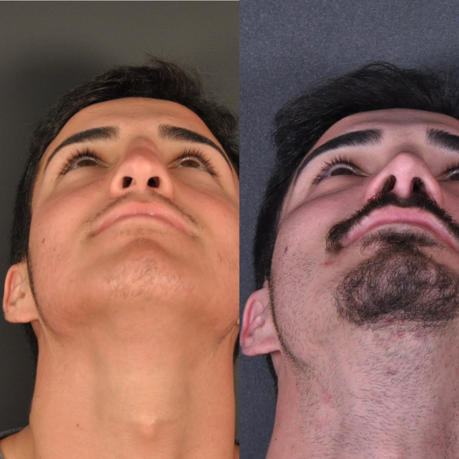 Antes e depois — perfil masculino 2