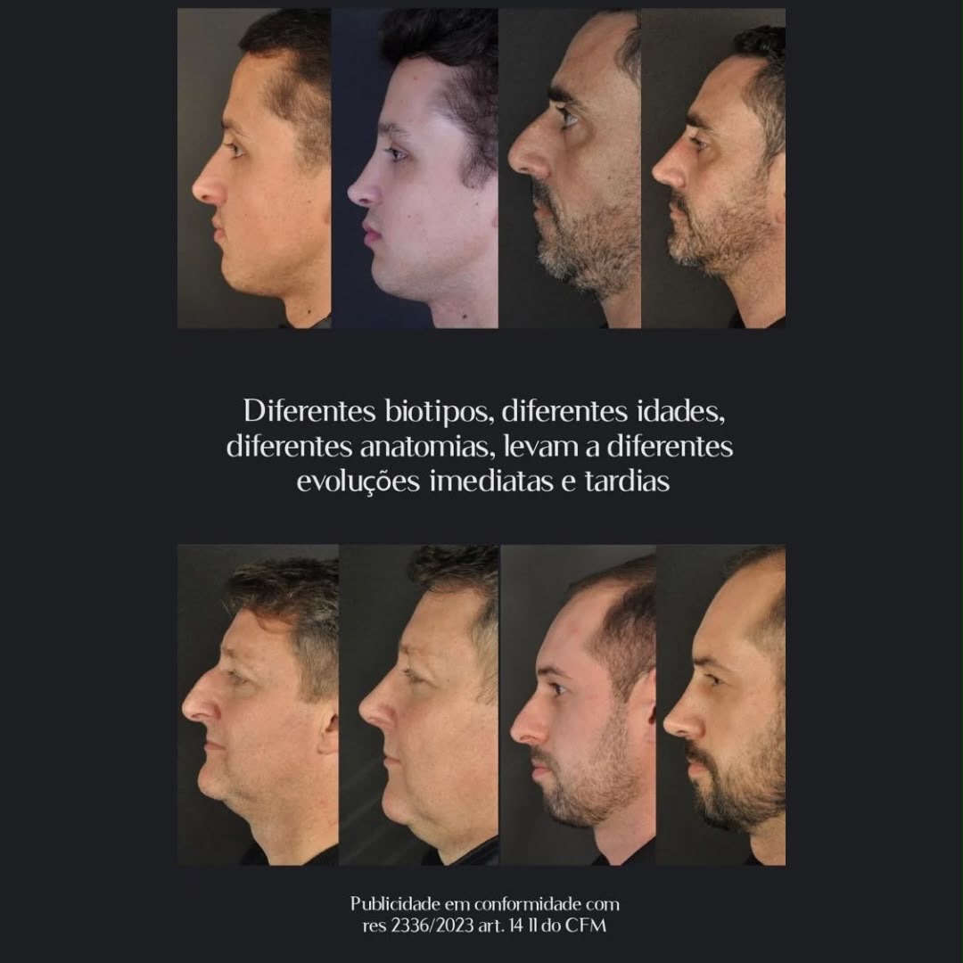 Diferentes biotipos — masculino