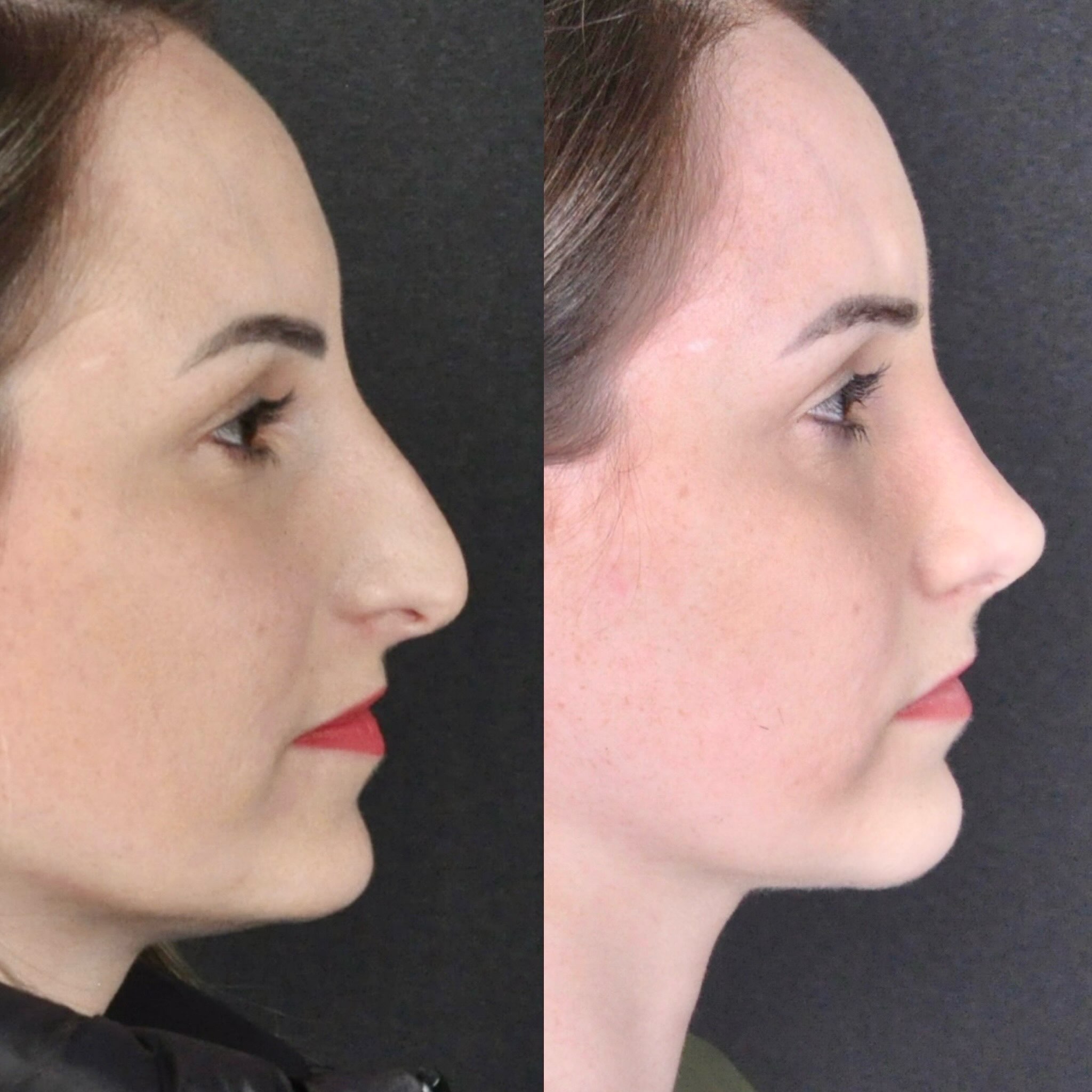 Antes e depois — perfil sorrindo feminino