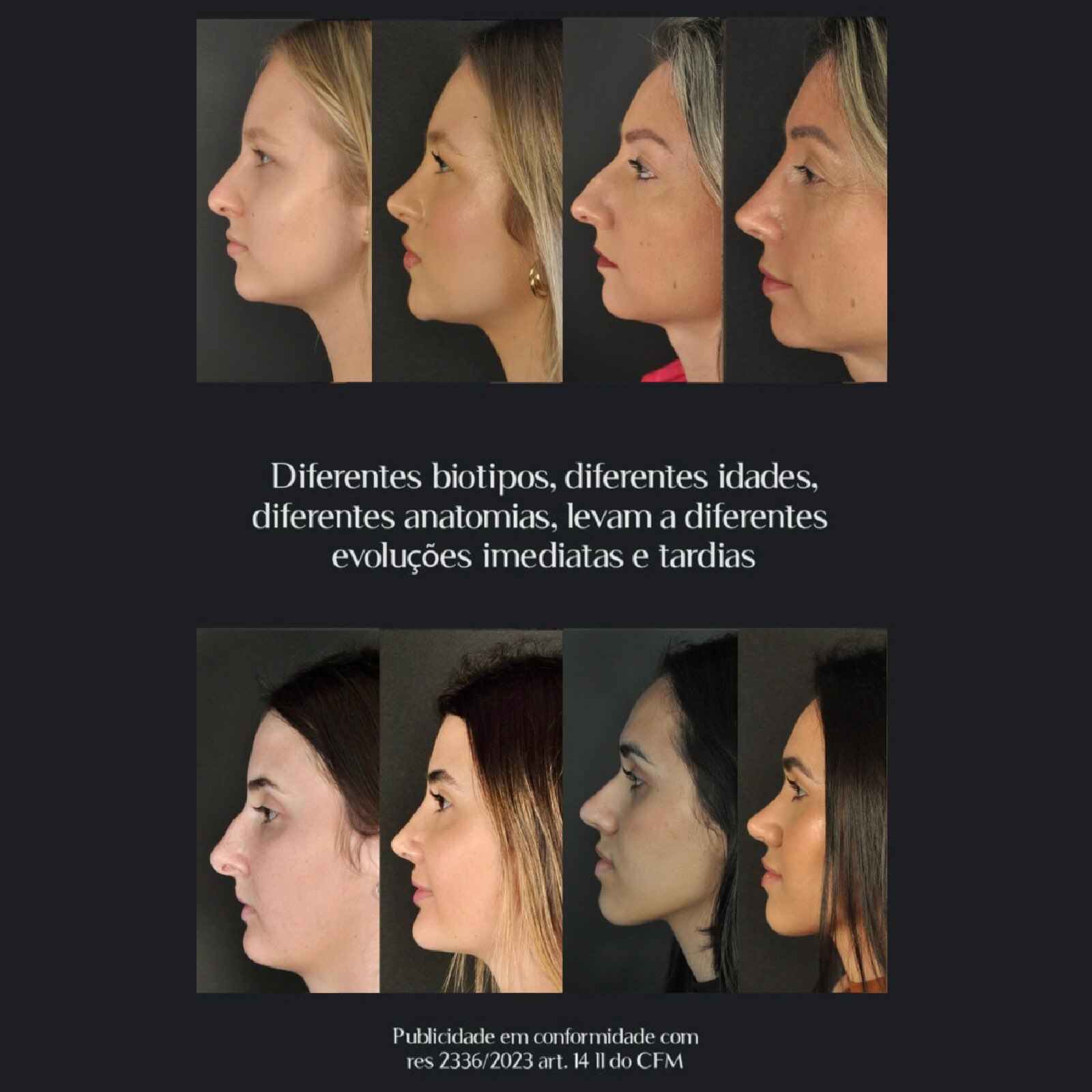 Diferentes biotipos — feminino